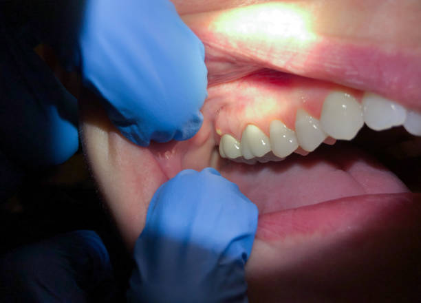 Best Urgent Dental Care in Merrifield, VA